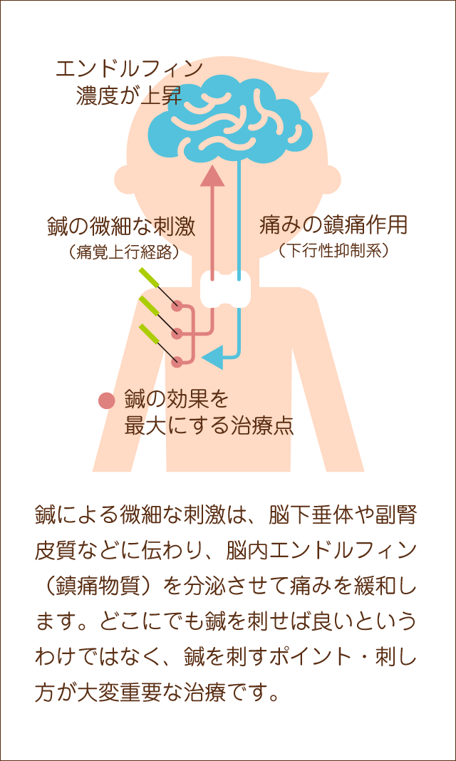 鍼治療の作用